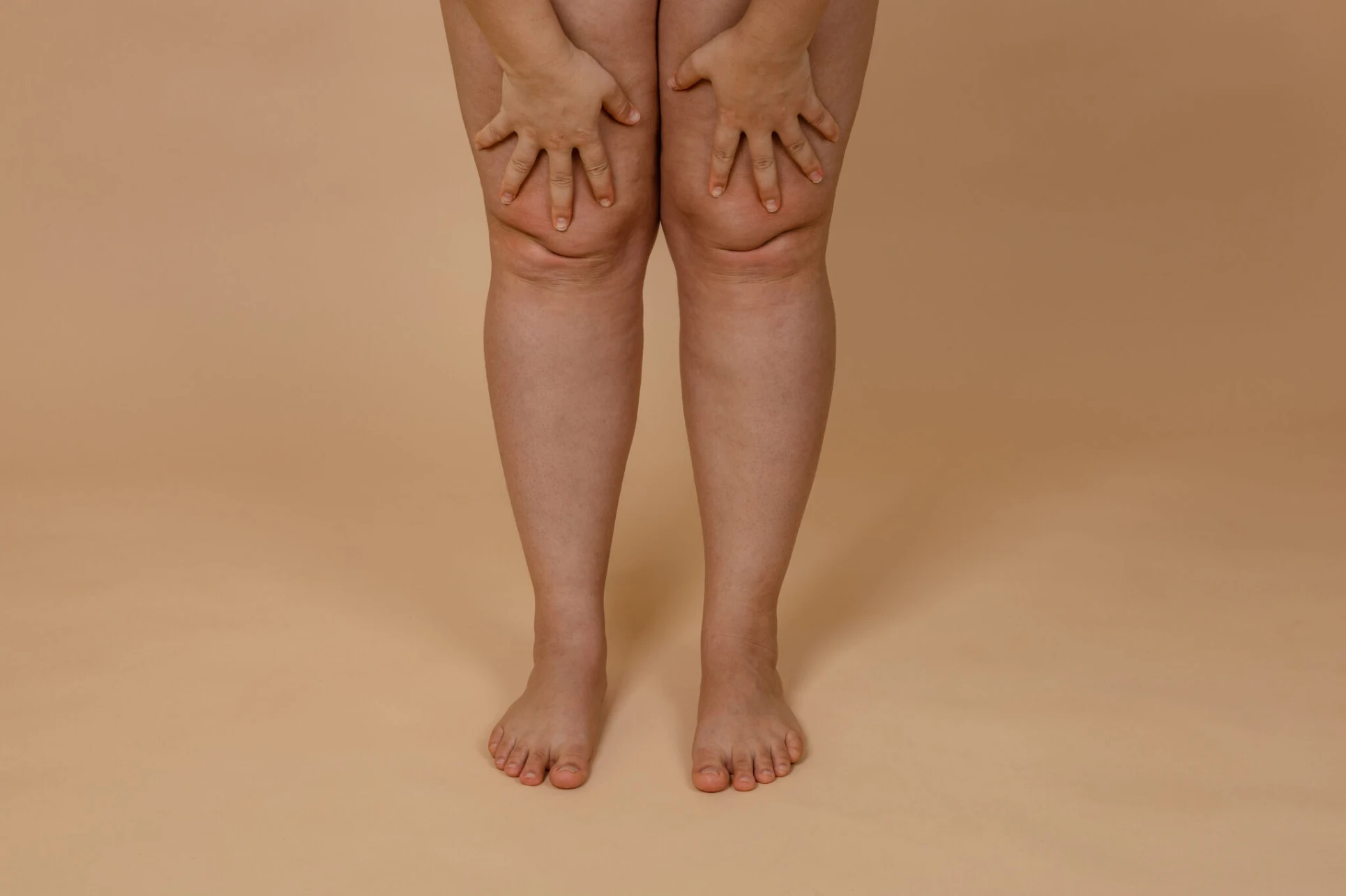 Post-op swelling improvement through lymphatic therapy